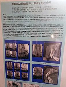 第15回　日本外傷歯学会